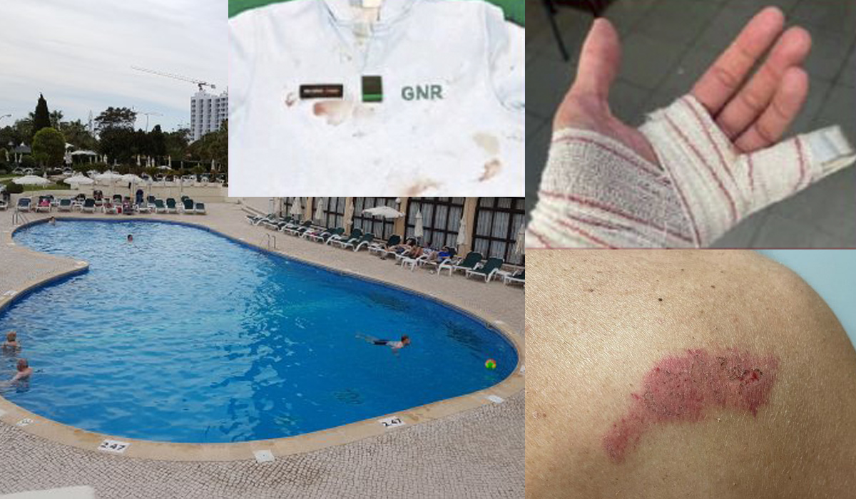 Read more about the article Militares da GNR espancados e atirados para piscina de hotel por grupo de ingleses