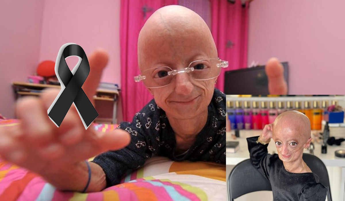 Read more about the article Morreu Cláudia Amaral, a menina que tinha uma doença rara: “Um dia quero ser recordada assim”