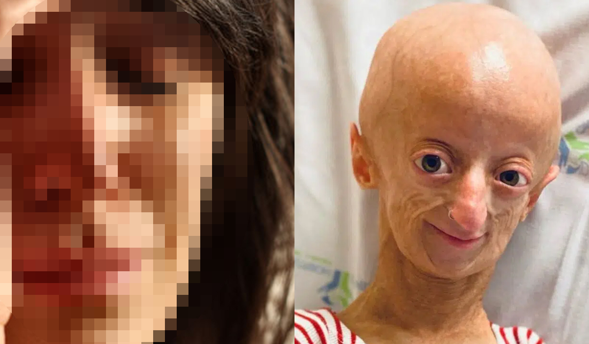 Read more about the article Mãe de menina que morreu com doença rara detida e impedida de ir ao funeral da filha por estar presa
