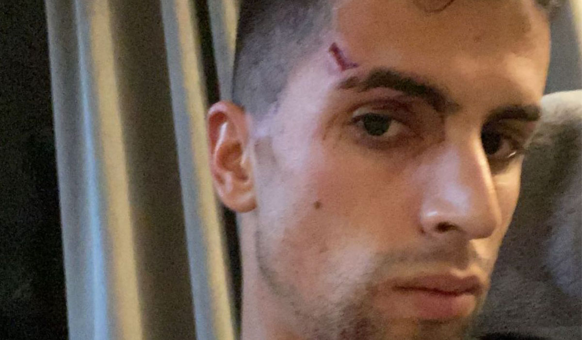 Read more about the article João Cancelo agredido por quatro homens durante assalto em Inglaterra