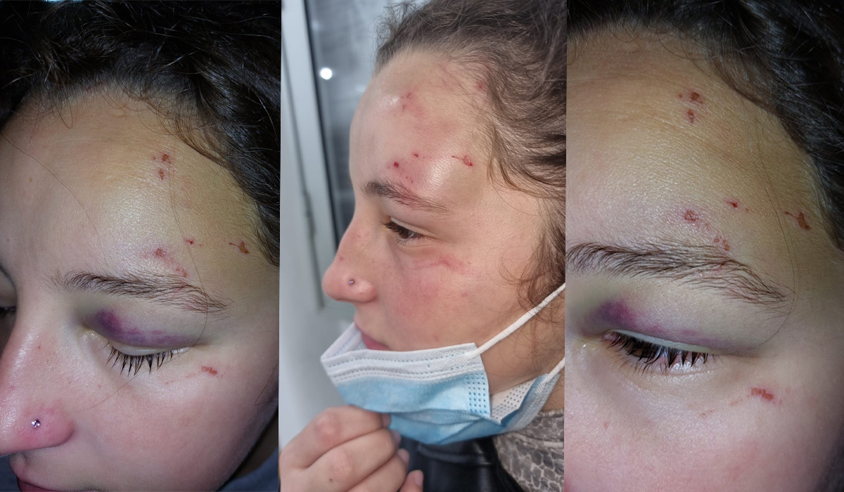 Read more about the article Jovem de 16 anos violentamente agredida pela atual namorada do ex-namorado no Barreiro