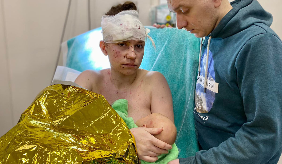 Read more about the article Mãe ucraniana protege filha bebé de bombardeamento com o próprio corpo em Kiev