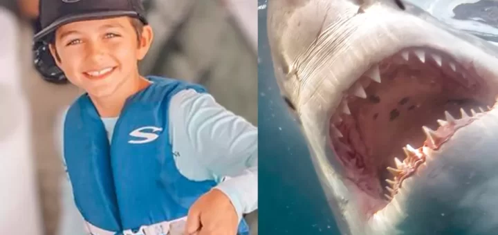 Menino de dez anos perde parte da perna em ataque de tubarão