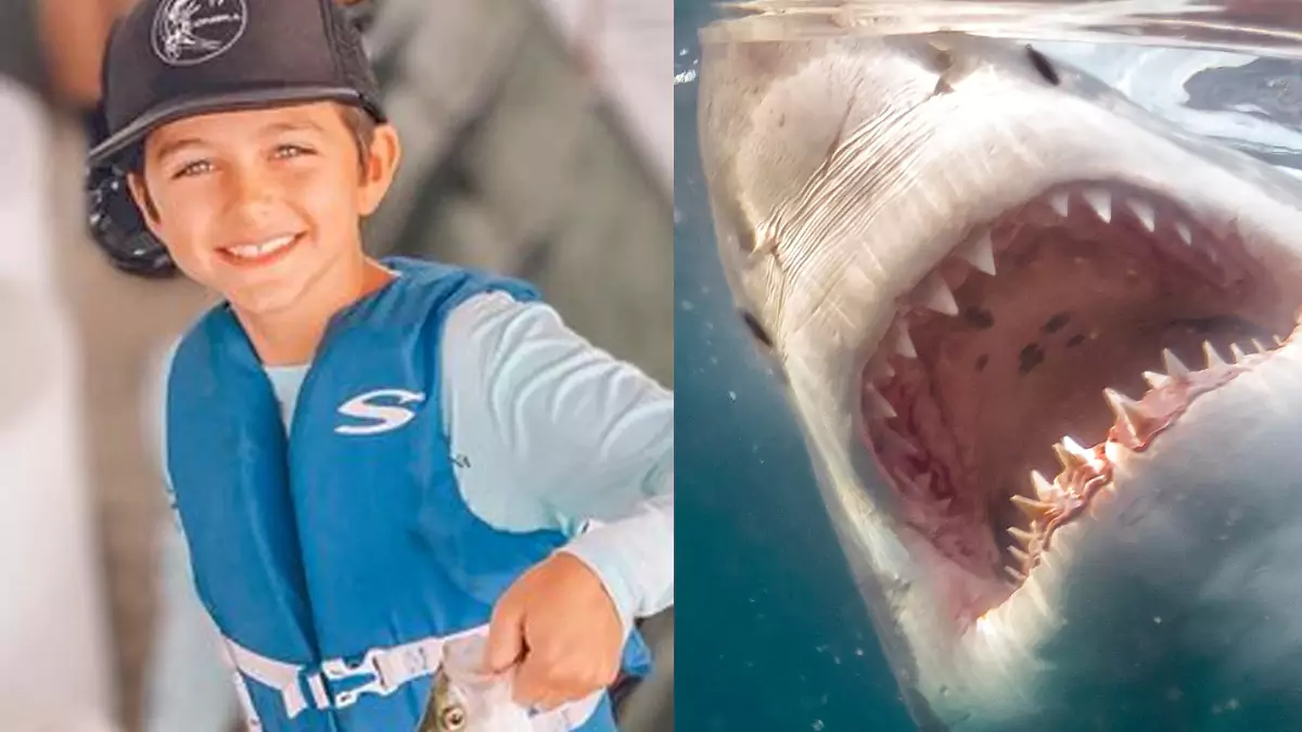 Menino de dez anos perde parte da perna em ataque de tubarão