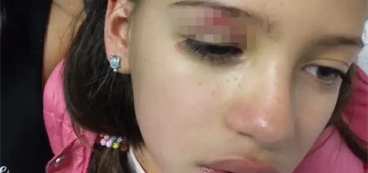 Menina luso-venezuelana de 9 anos agredida por colega em Curral das Freiras. Pai fala em "xenofobia"